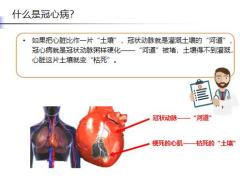 早會(huì)健康專題心血管重大疾病解析15頁(yè).pptx